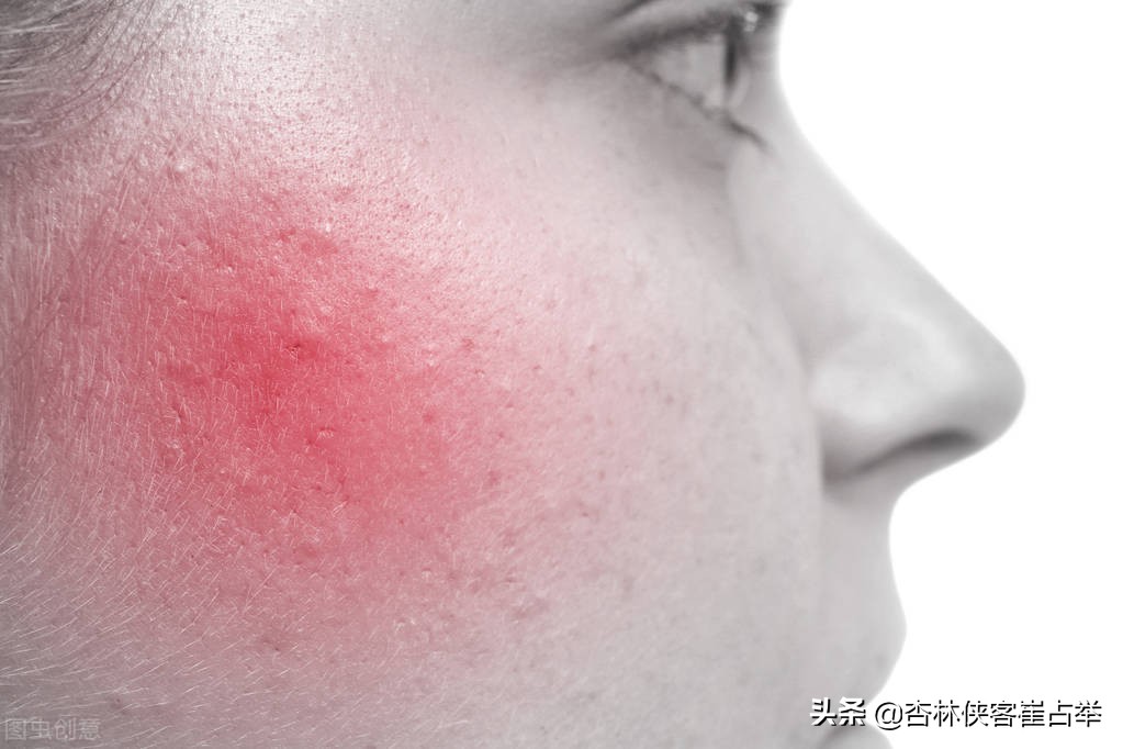 上火怎么办中医教你分清五种火,中医如何看待身体一侧上火严重