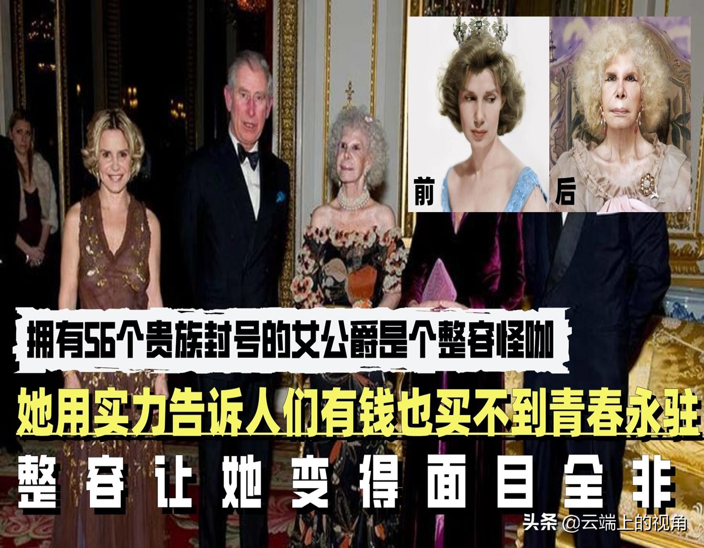 西班牙公爵是个整容怪咖，她用亲身经历告诉人们有钱也买不到美貌