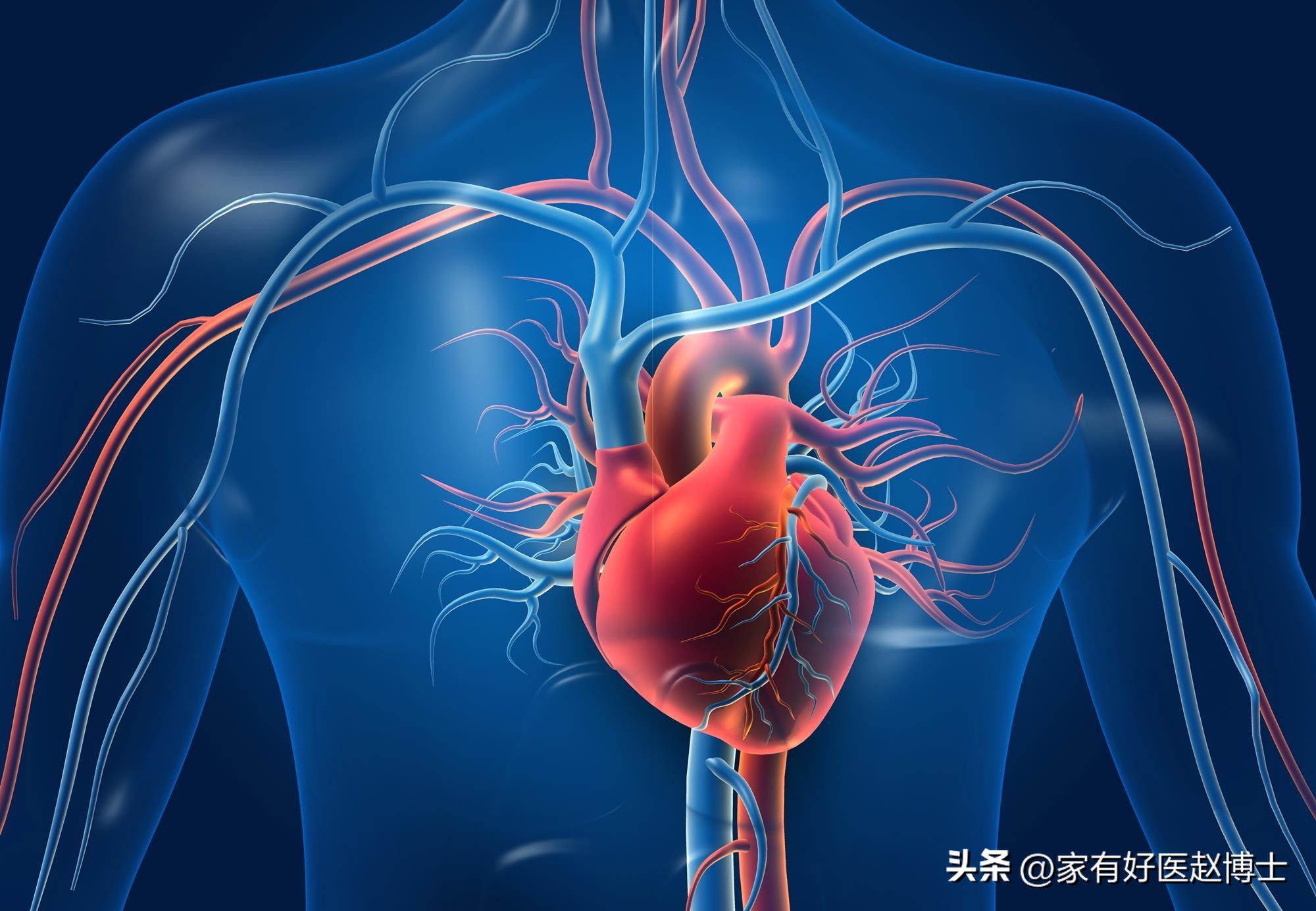 体检提示心血管局部钙化,体检发现冠脉见钙化影是什么意思