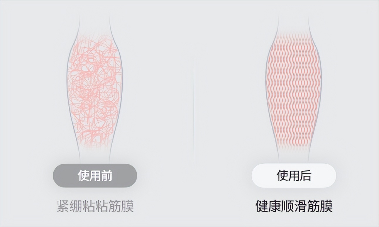 筋膜枪测评平价100以内,100块筋膜枪测评推荐