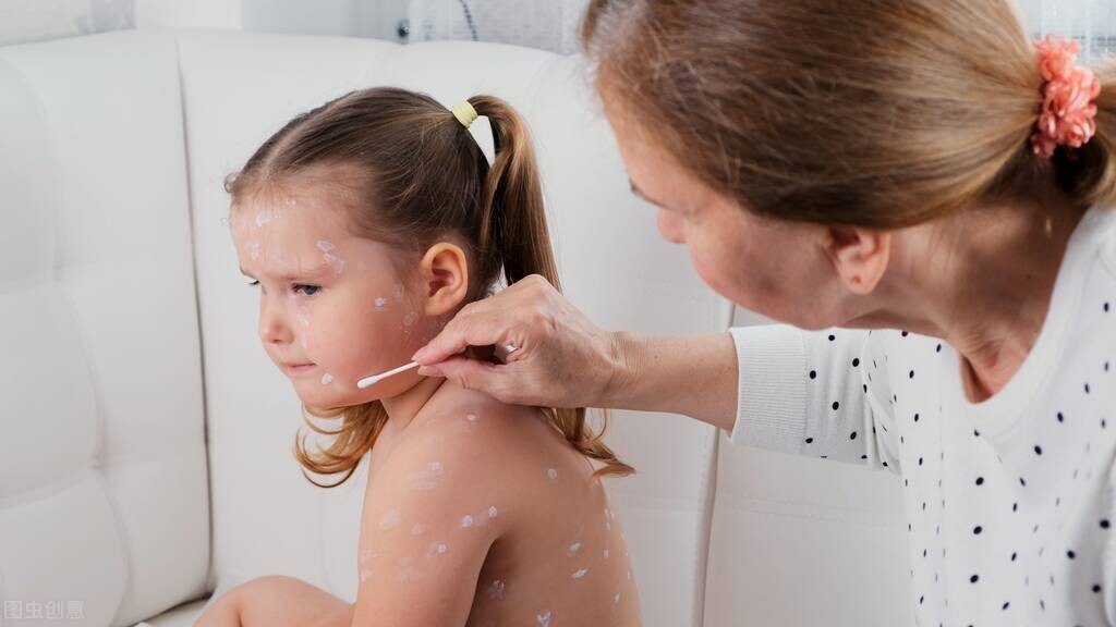 疱疹水痘怎么治疗效果最好,单纯疱疹和小时候水痘有关系吗