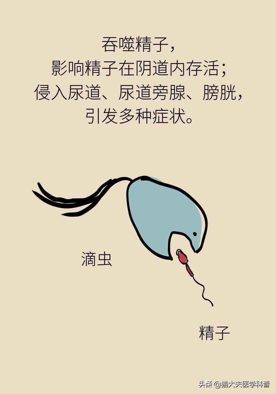 滴虫性阴道炎会不会没有症状,滴虫性阴道炎的症状会传染吗
