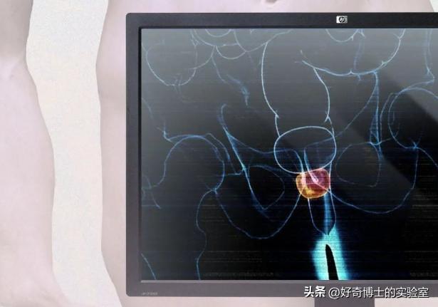 什么坐姿不易诱发前列腺炎,前列腺最怕的5个坏习惯