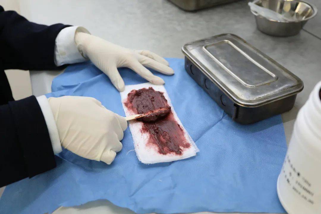 治疗肛裂生肌的药,有没有秘方治疗肛裂的