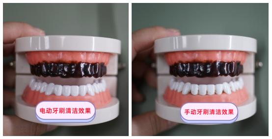 电动牙刷怎么避免伤牙龈,劣质的电动牙刷会造成的伤害