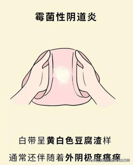 住院期间医生叫我去门诊开药,住院医生为什么要我去门诊买药