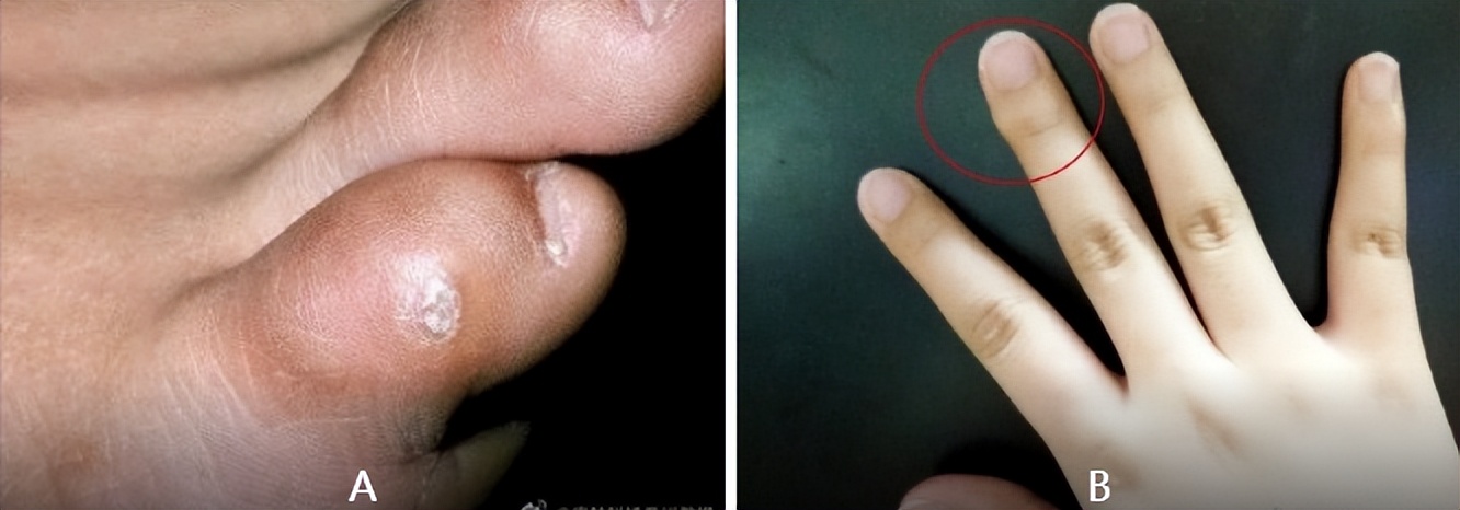 看图猜哪个是真哪个是假,看图猜猜哪个是真的哪个是假