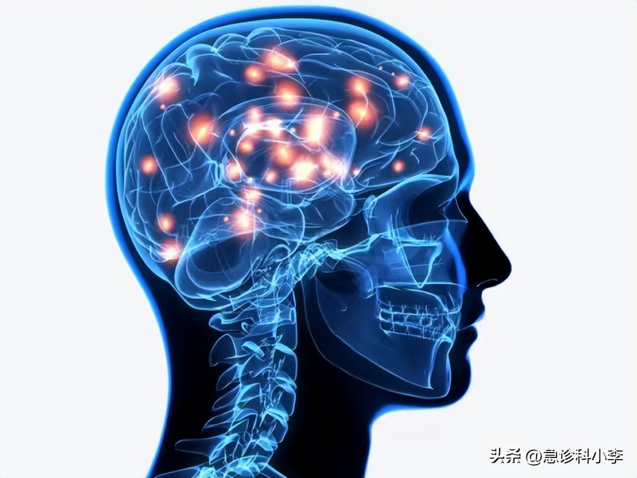 降压药伟哥,3种降压药组合降不下来血压