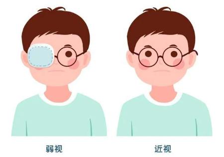 小孩弱视遮盖又极不配合怎么办,散光弱视穿珠子要遮盖吗