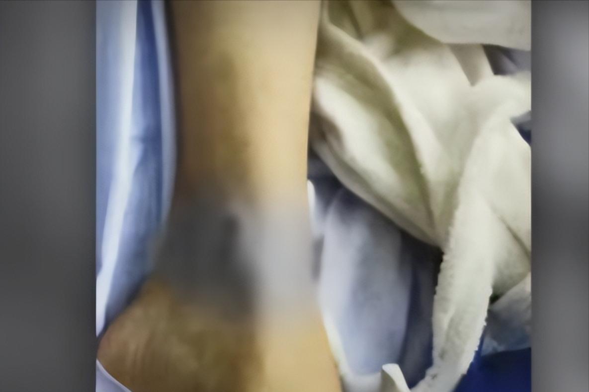 23岁空姐和11名男子跨年聚会后，被发现死于酒店浴缸，死因为何？