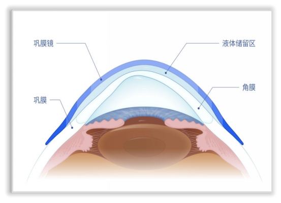 郑州眼科医院全飞秒设备,郑州视光眼科的仪器