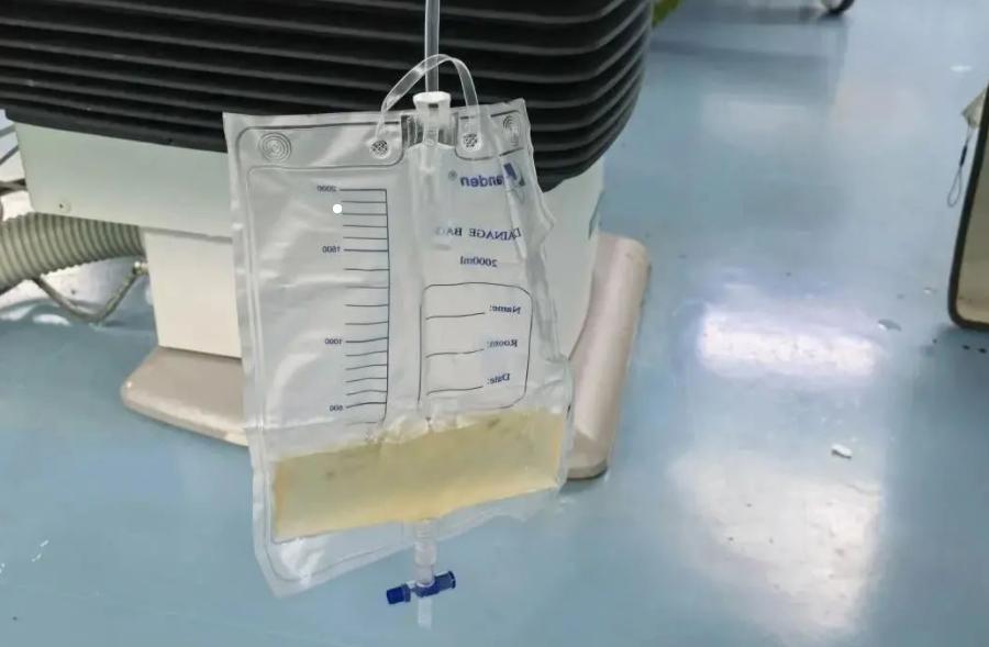 裤子脱到膝盖的检查,裤子脱到了膝弯处检查