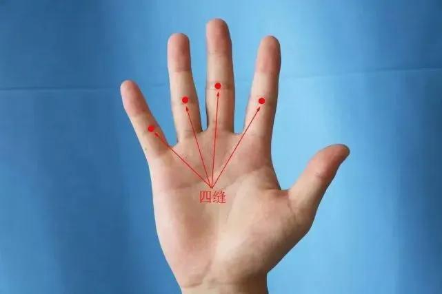 小儿是如何挑疳积的,挑疳积的原理是什么