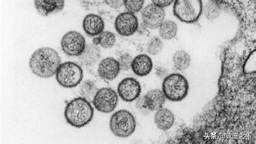 地球上十大可怕的病毒,地球上最厉害的十种病毒都是什么