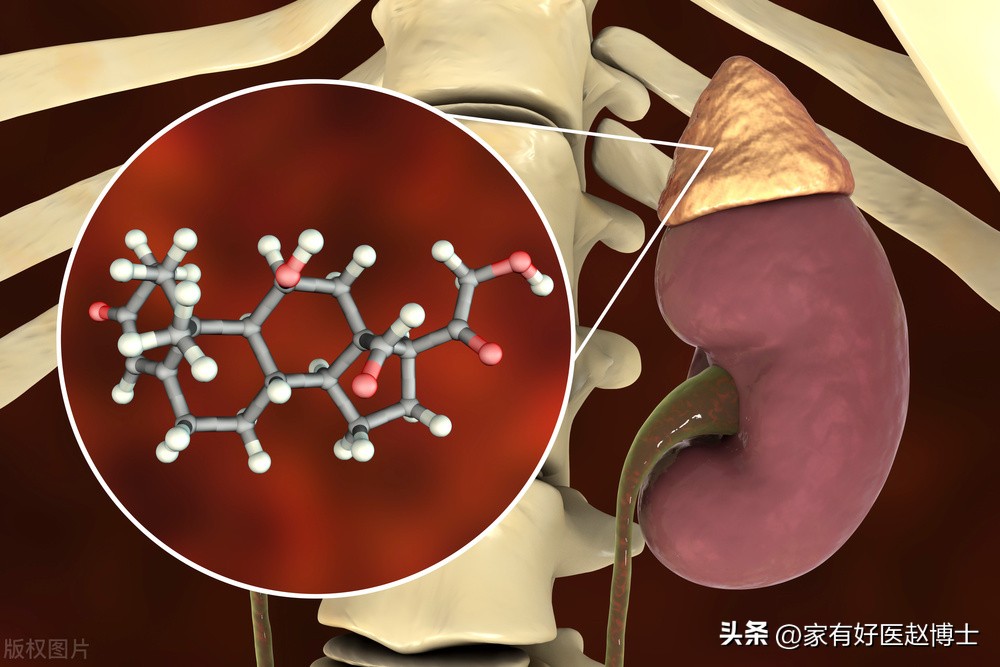 糖尿病得新冠血糖降不了怎么办,糖尿病人感染新冠血糖升高怎么办