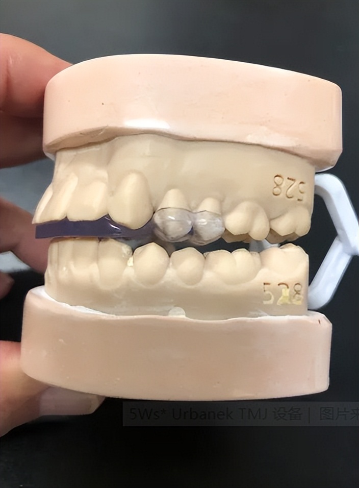 口腔正畸托槽带量采购,口腔正畸集采2024