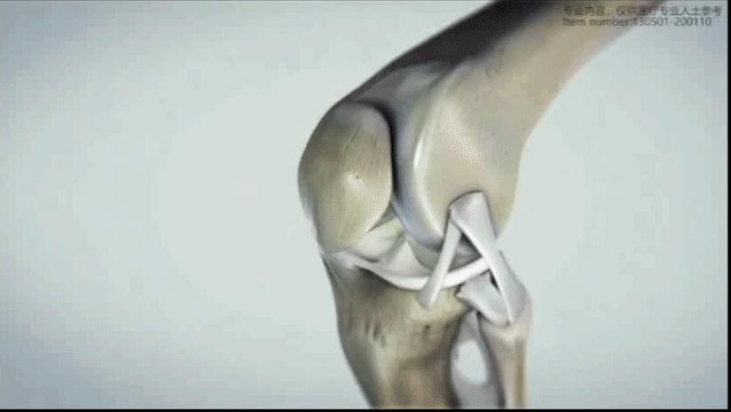 半月板缝合有后遗症吗,半月板缝合后康复训练