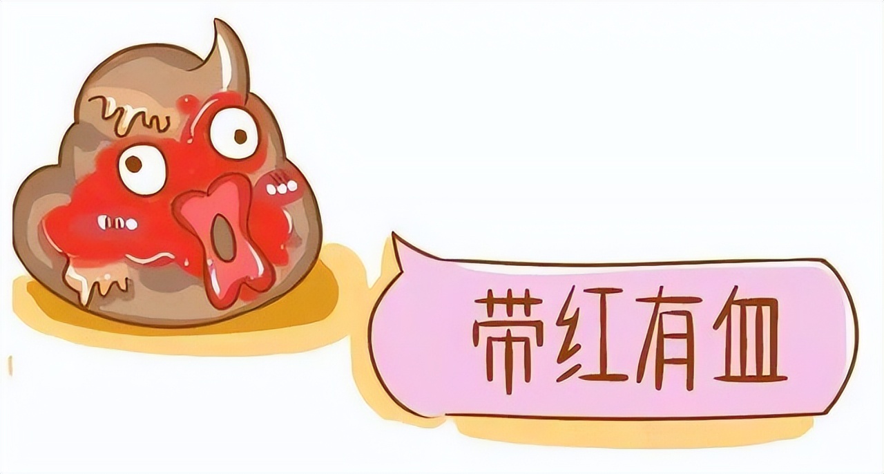 你需要了解的有关肛门癌的知识,肛门癌的症状和前兆有治疗方法吗