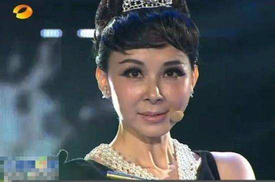 老演员整容脸变形,老年人整容前后照片