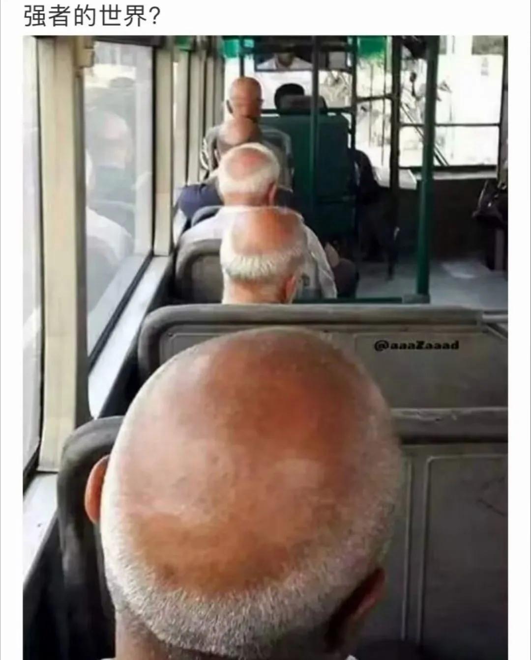 为什么我每天掉头发但还是没秃,总是掉头发快秃了怎么办