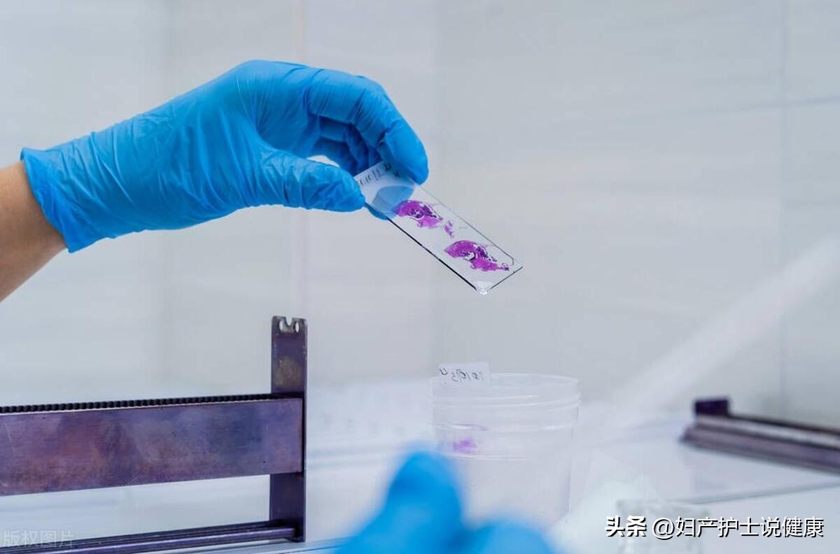 tct宫颈防癌筛查未婚可以做吗,tct筛查癌的概率多大