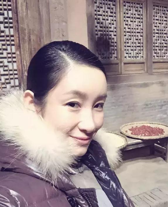 女子割双眼皮失败像瞪眼,女明星割双眼皮对比照