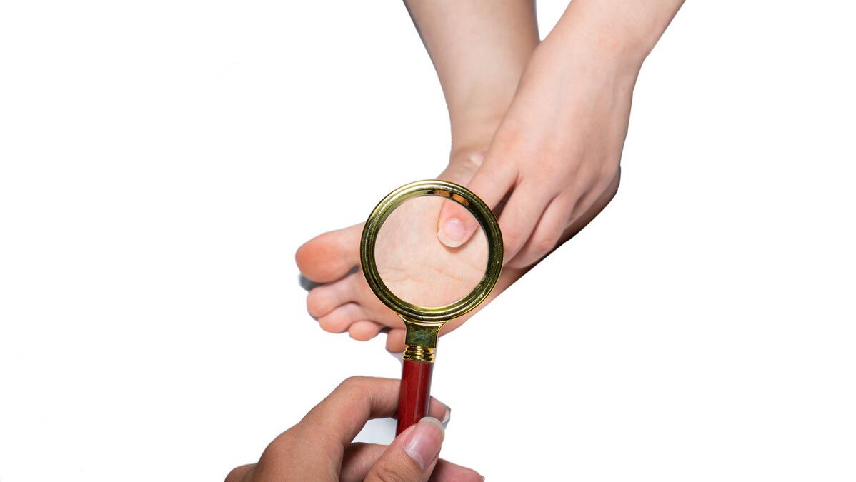 脚趾缝糜烂但是不痒,脚趾缝痒长水泡糜烂脚臭