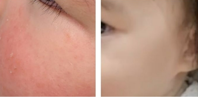 宝宝面霜推荐排行榜前十名折扣款,宝宝面霜哪款好无激素