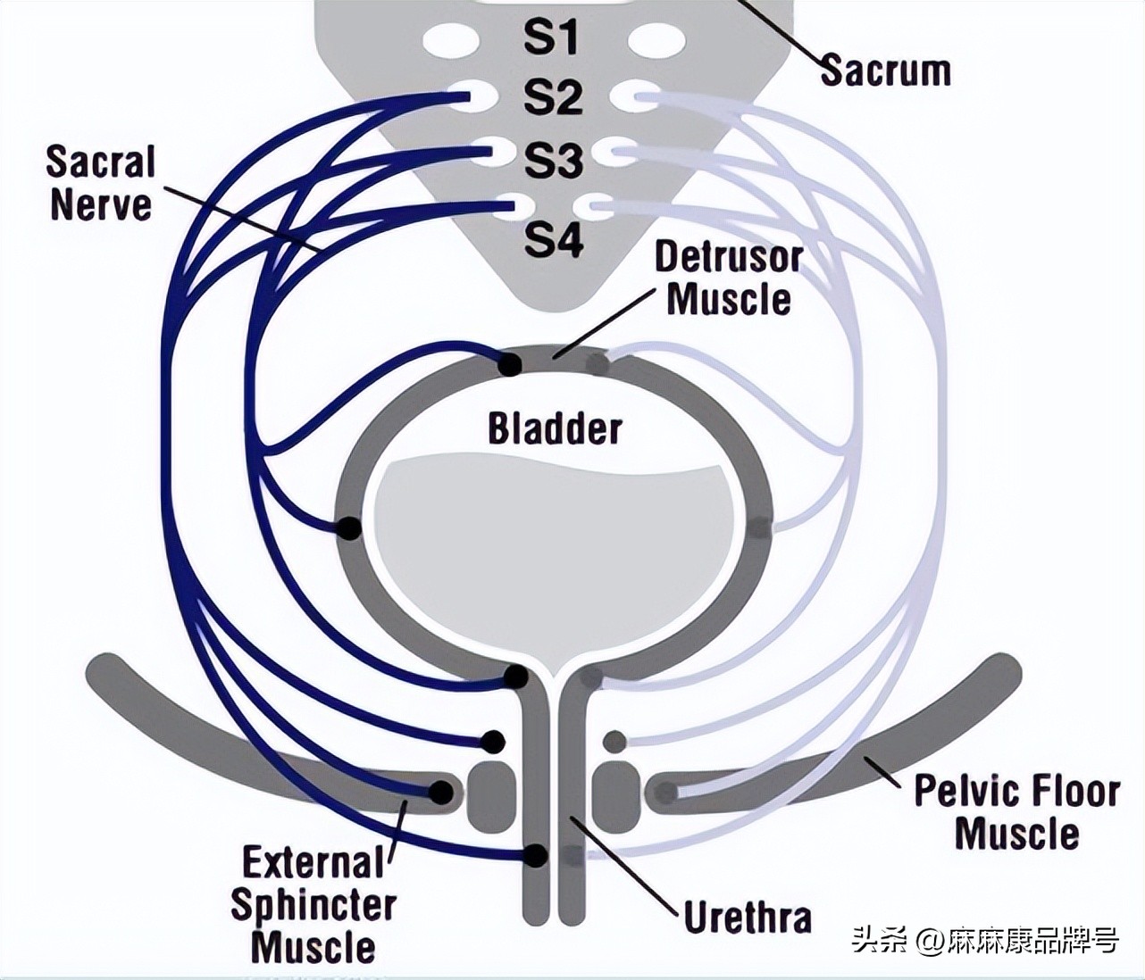 盆底肌电刺激与磁刺激的区别,什么是盆底磁刺激