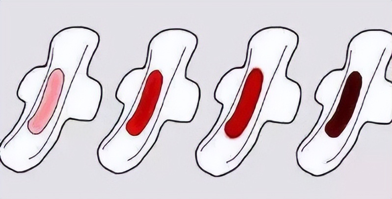 女生来月经流出的血块是什么,来例假流出一大坨血块