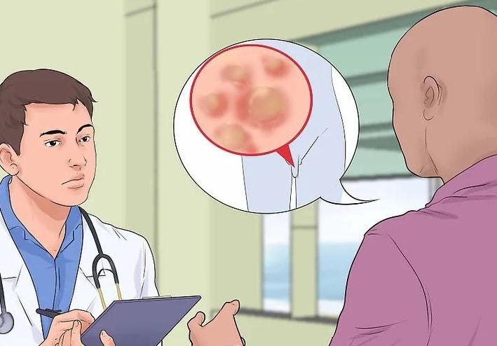 别错把艾滋病当成皮肤病,不要把艾滋病当皮肤病