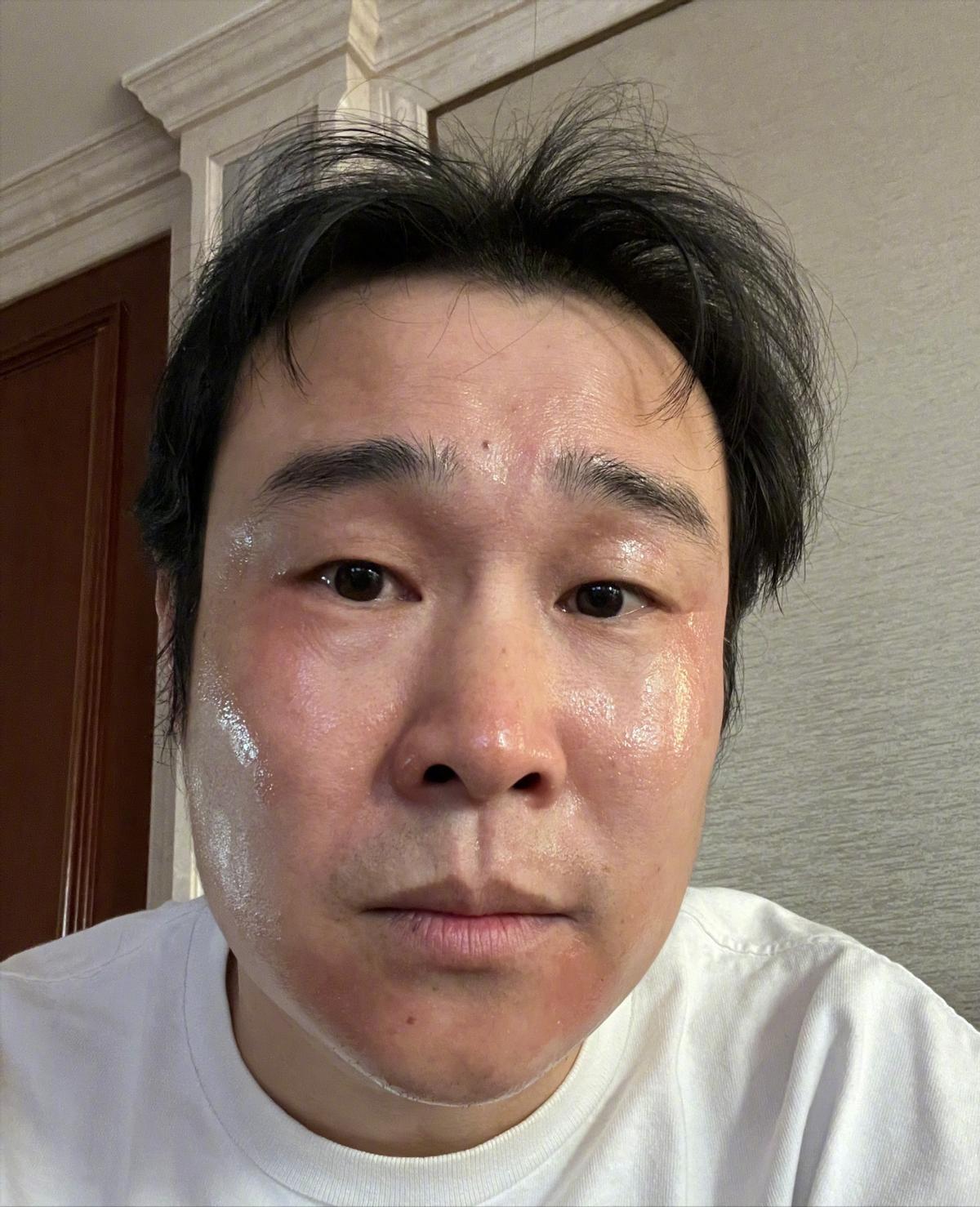 确诊阳性的明星,被确诊为阳性的明星