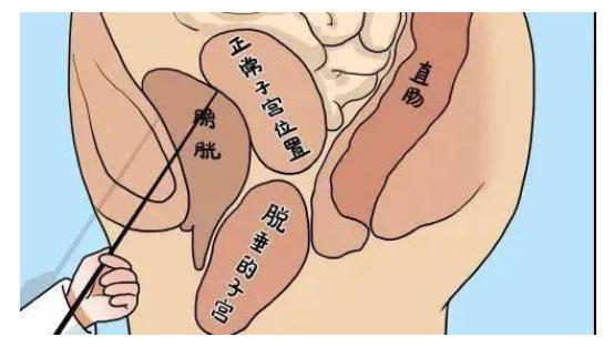 濂冲瓙渚跨瀵艰嚧瀛愬鑴卞瀭,鏀惧眮瀵艰嚧瀛愬鑴卞瀭