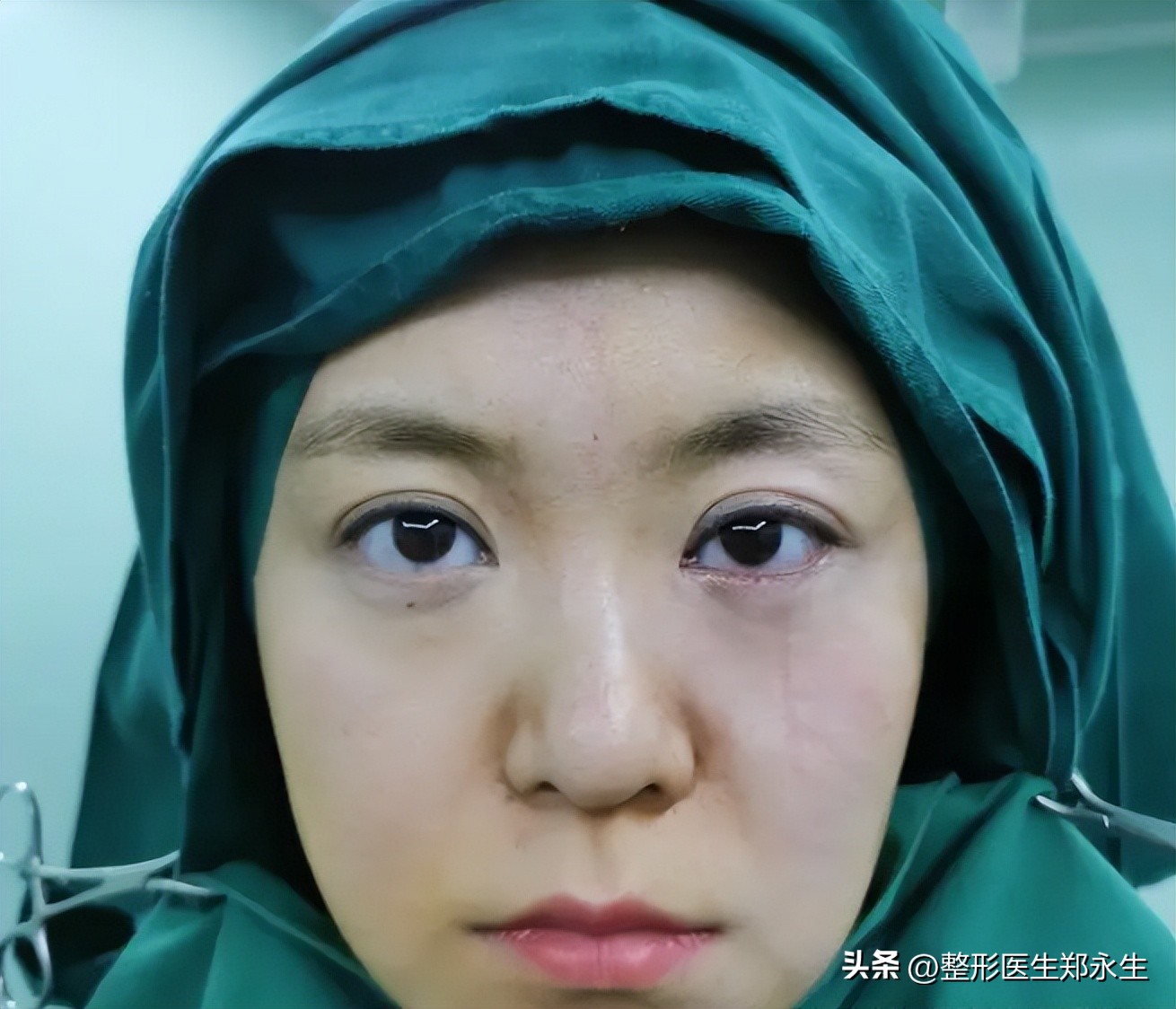 下眼睑磨得慌发涩怎么回事啊,下眼睑干的起皱起皮怎么回事