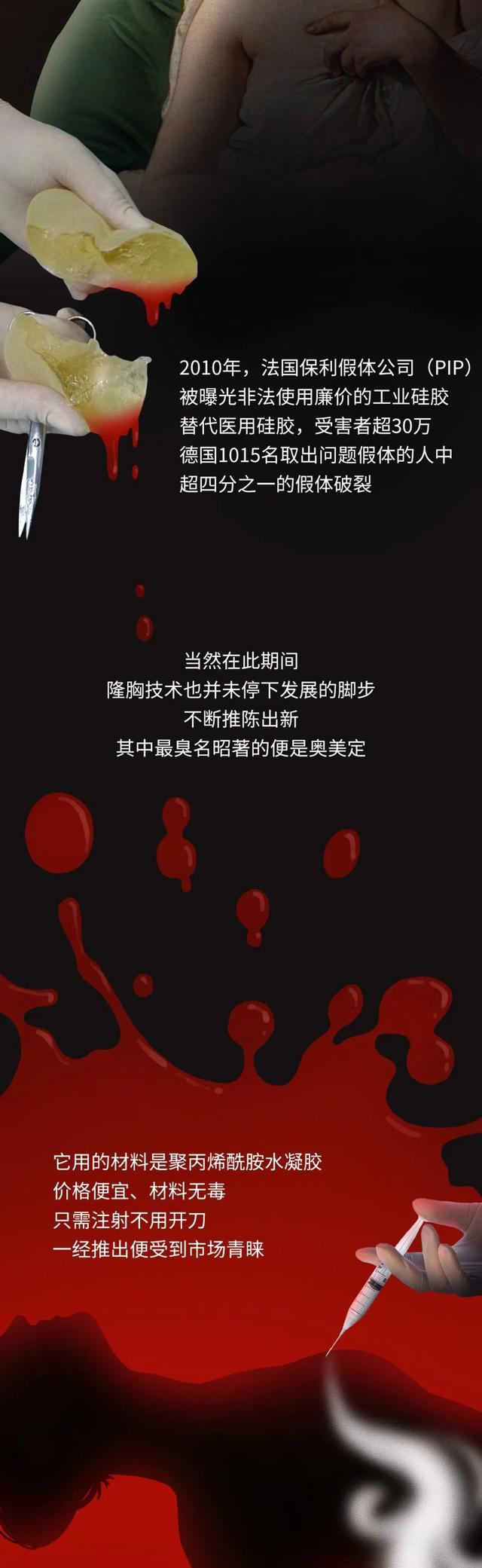 第一批假体隆胸的人现在如何,第一批脂肪隆胸的人现在怎么样