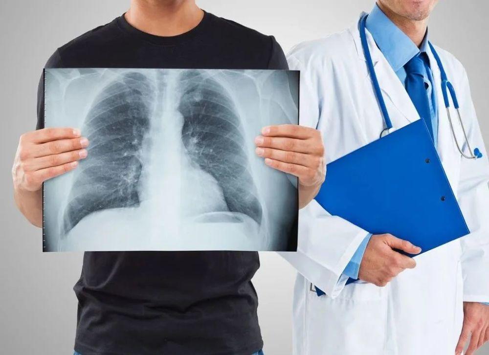 大蒜是肺结节发物吗,大蒜对肺结节有影响吗