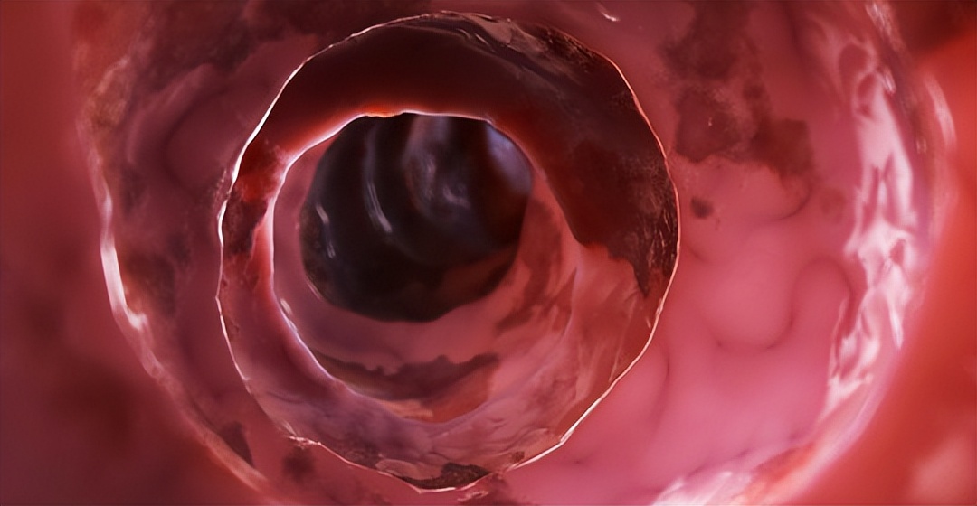 50岁没有得过4种病说明你很健康,50岁的人要注意哪些疾病