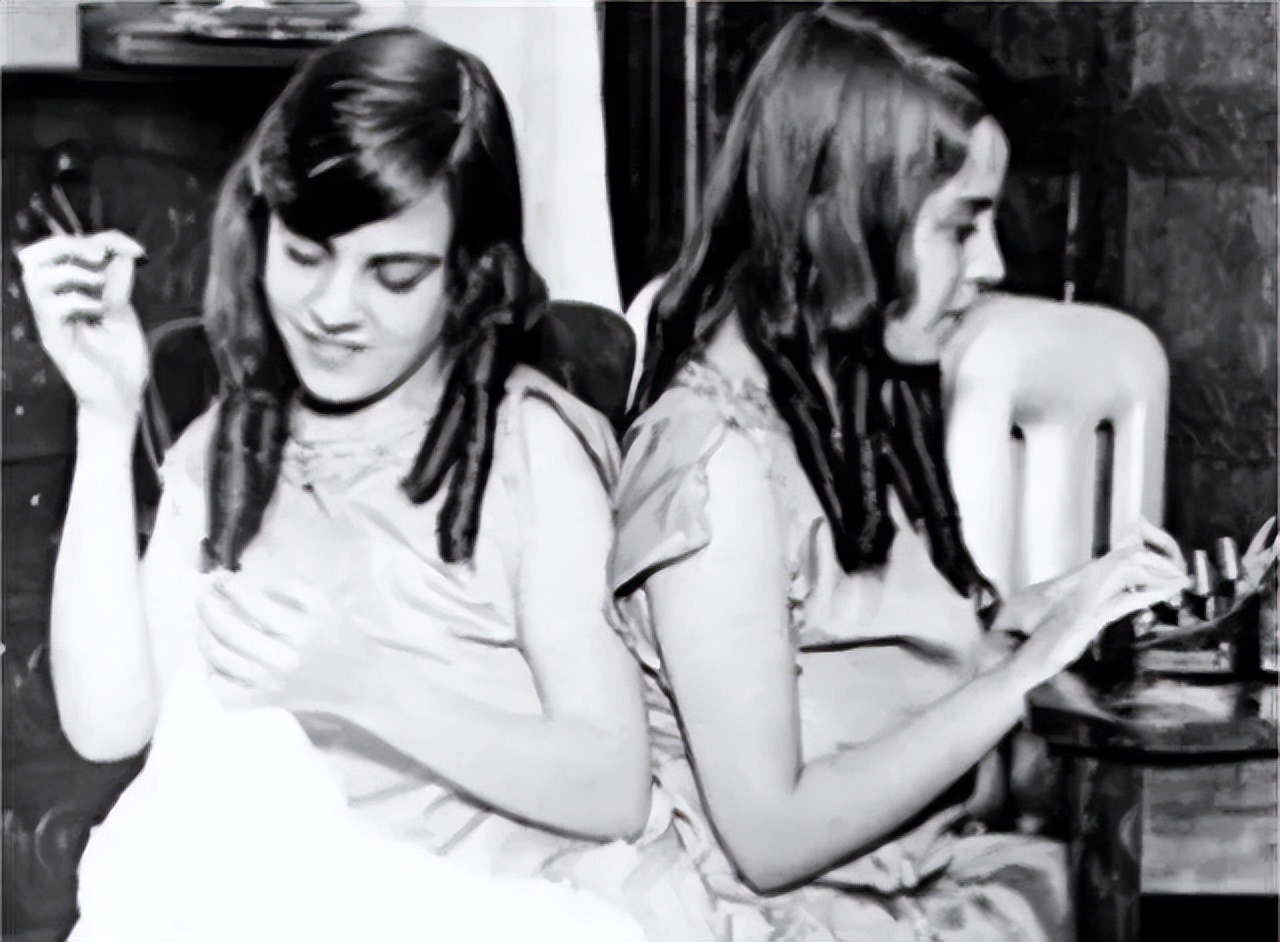 英国连体姐妹分离手术大结局,英国连体姐妹姐姐死后怎样