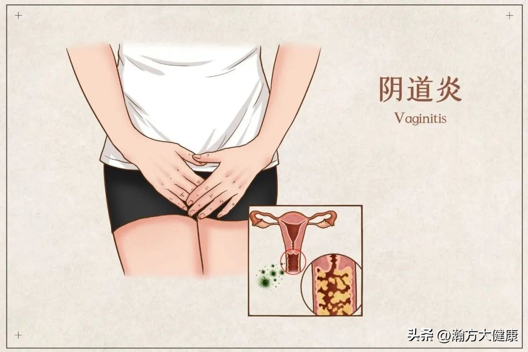 屁股经络淤堵一按很痛,推臀部排毒正确手法完整视频