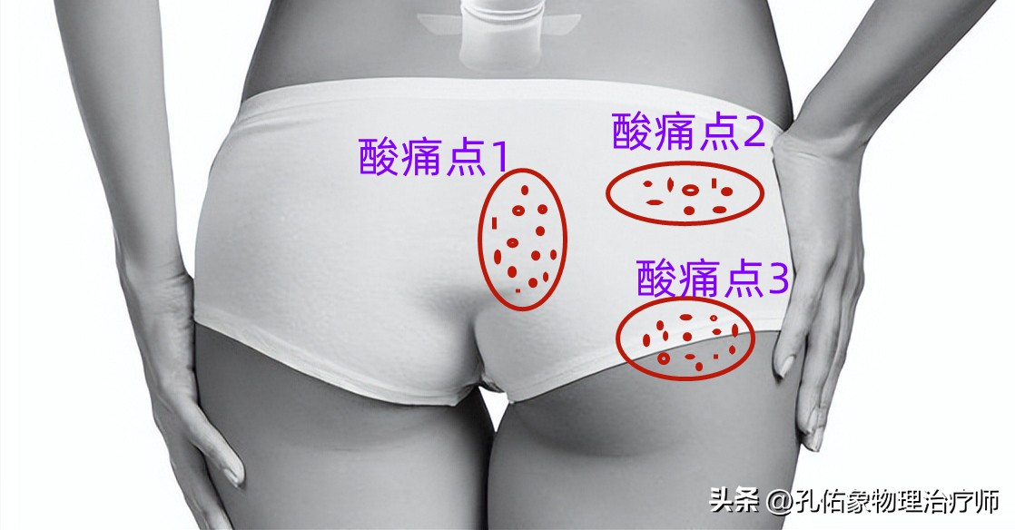 屁股疼是腰突导致的吗,屁股酸痛什么预兆