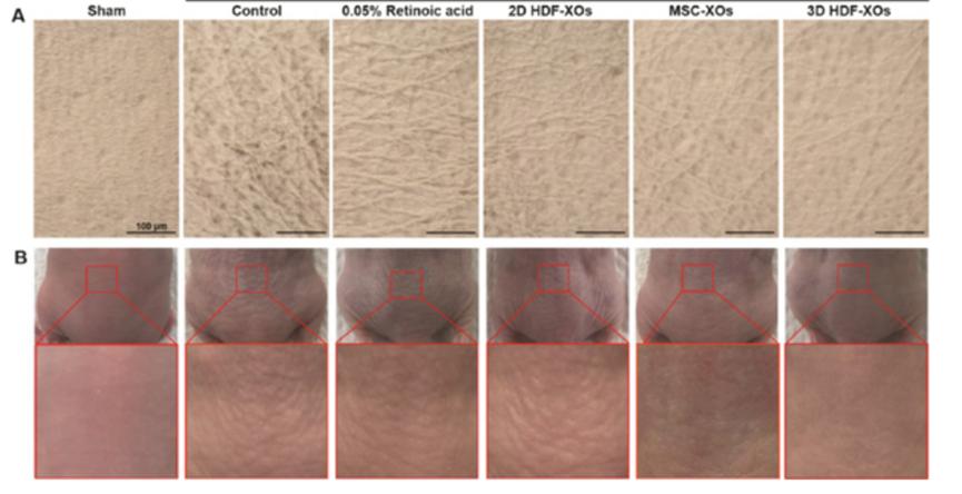 外泌体护肤品运用,国外外泌体应用