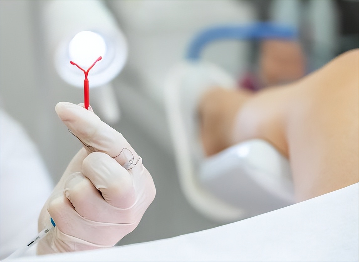 女性上环过程是怎样的,女性上环的全流程