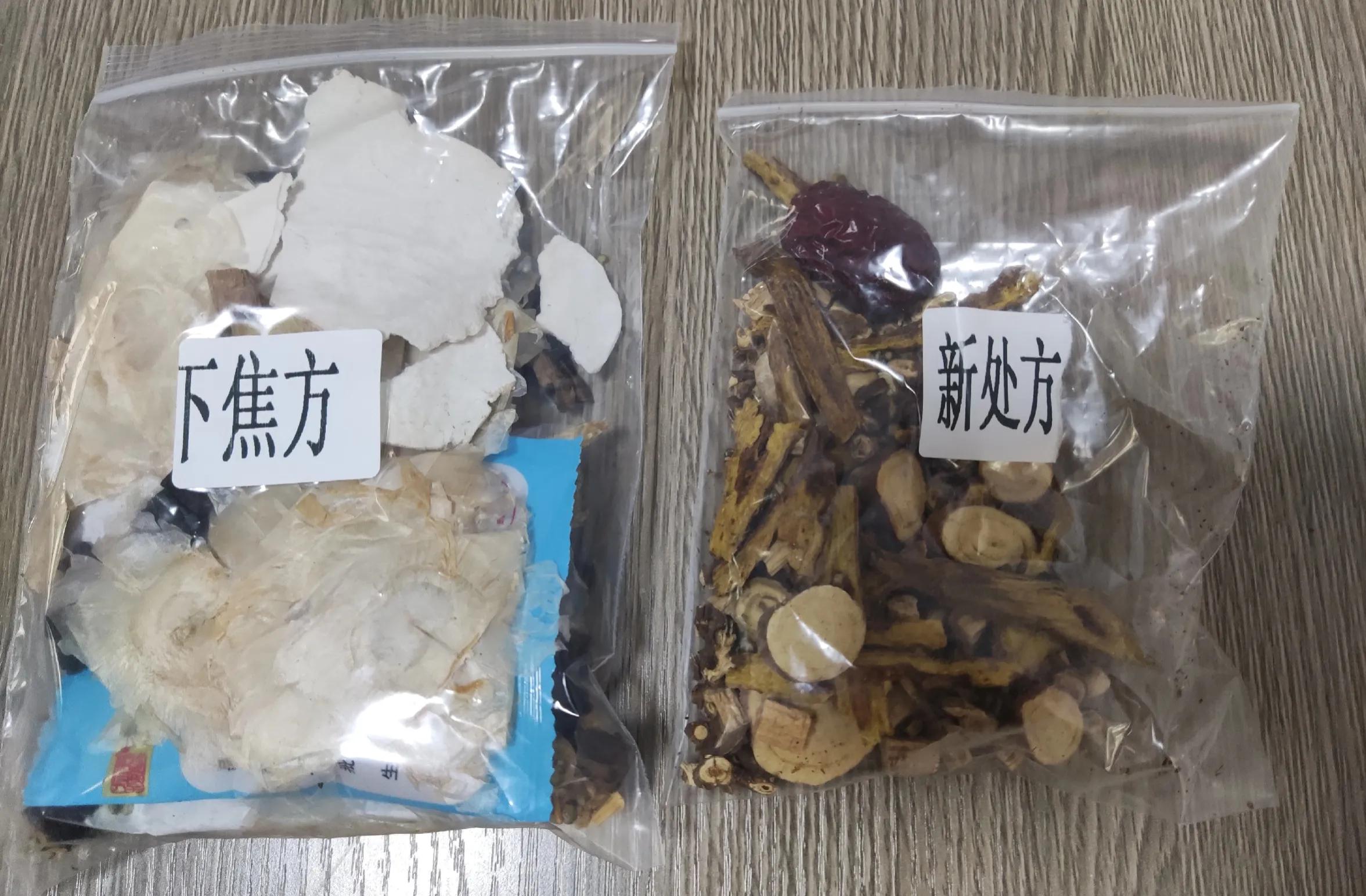 萎缩性胃炎喝中药多长时间起效果,一天2顿调理胃中药最佳时间