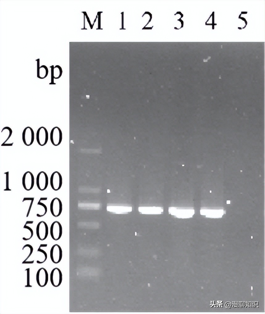 大肠杆菌的结构名称,大肠杆菌菌株基因型