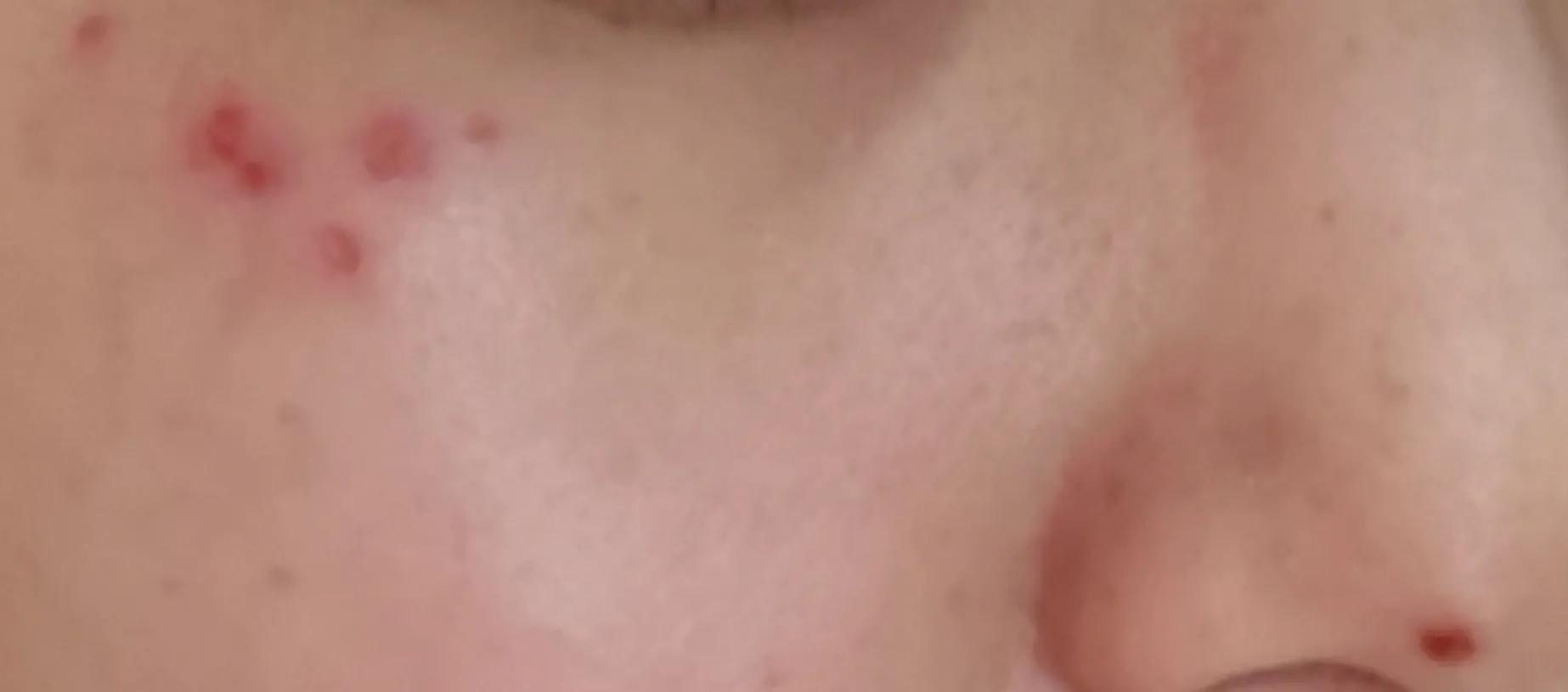 医院里的皮肤美容科靠谱吗,美容院做皮肤护理毁容怎么办