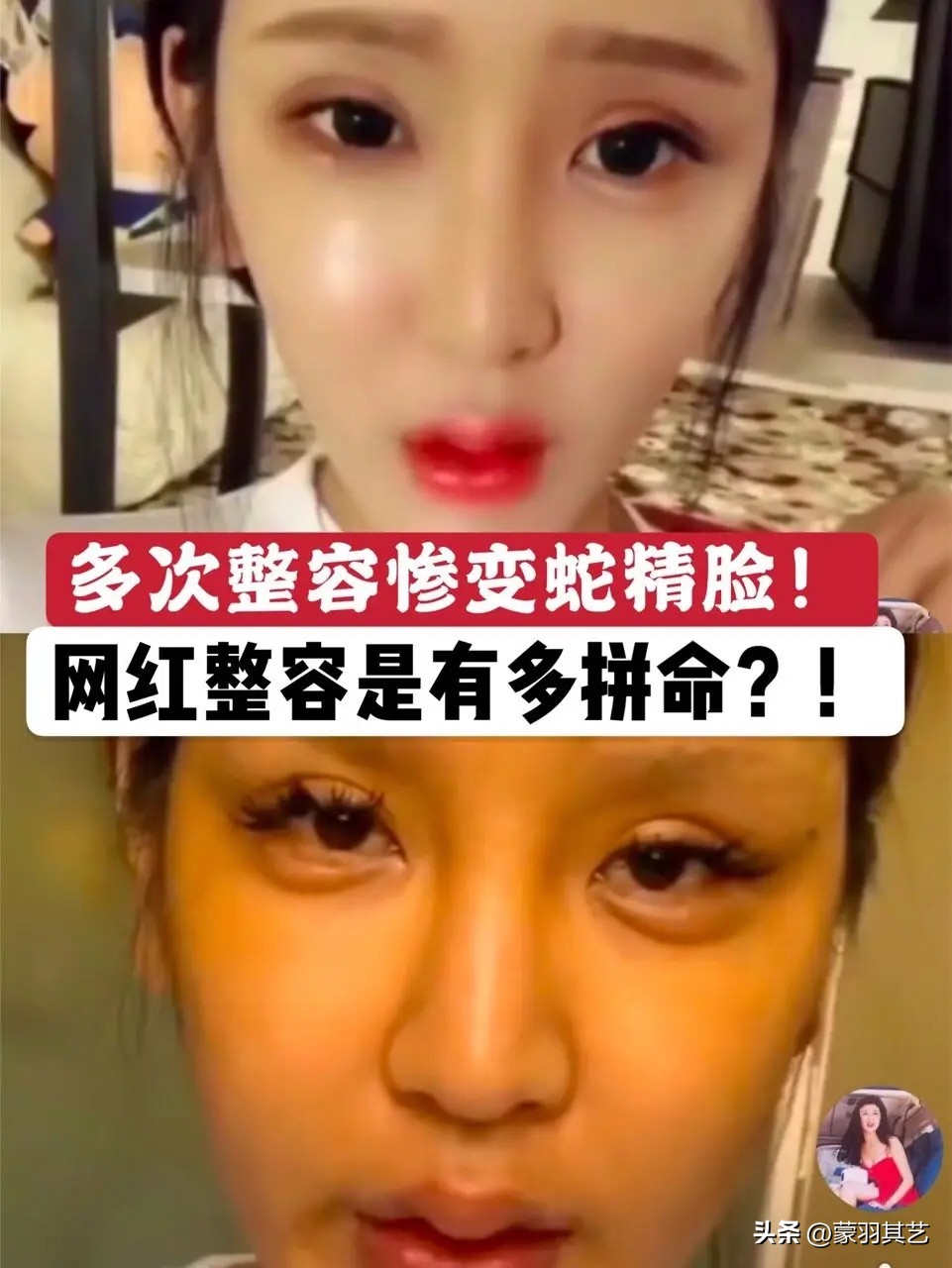 希望有一天，能禁止“整容脸”出镜，满屏硅胶玻尿酸，实在看吐了