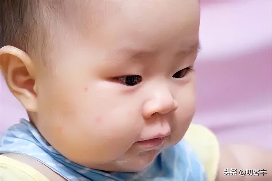 七岁孩子脸上长小米粒疙瘩像痱子,孩子痱子有什么特效药