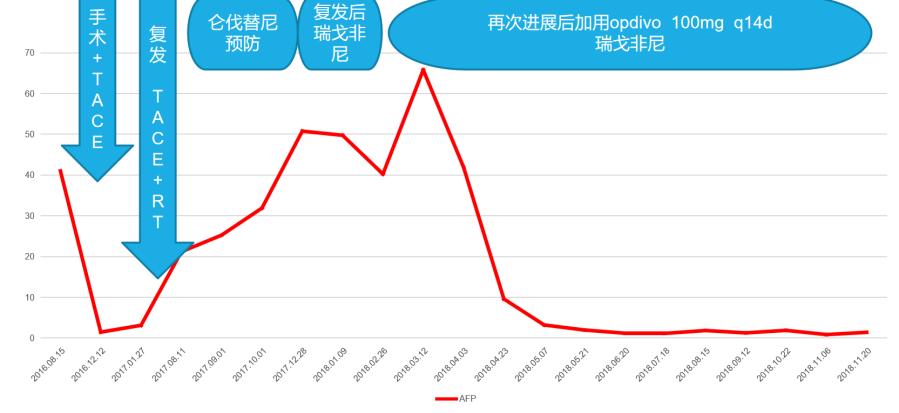 放疗肝内胆管细胞癌能治好吗,放疗治疗肝门静脉癌栓
