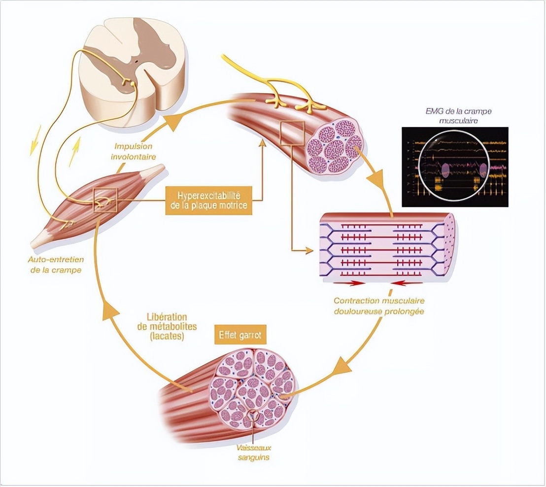 测评口碑最好的筋膜枪,测评筋膜枪热门