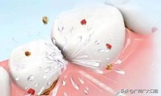 牙齿美白最好的方法又省钱,牙齿美白的4种方法亲测有效